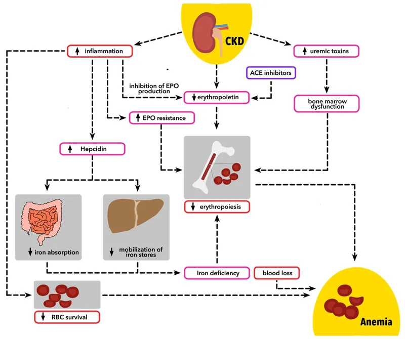 Pathophysiology of Anemia in CKD