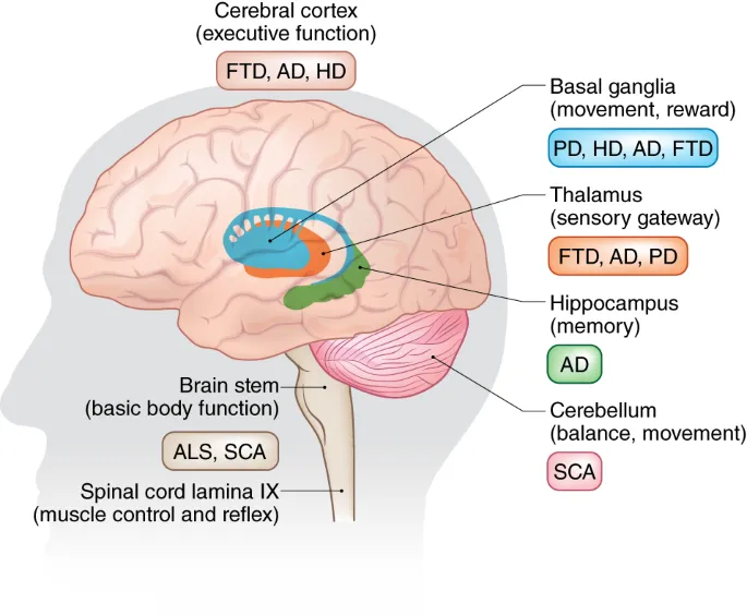 Brain regions affected by neurodegenerative disorders