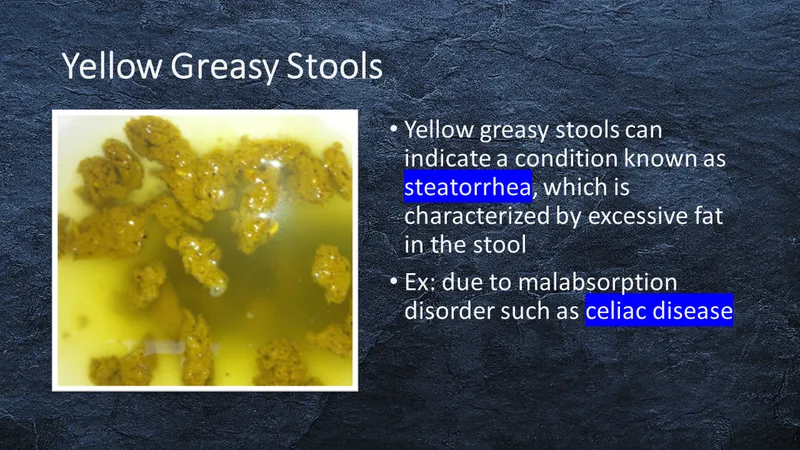 Steatorrhea: Yellow, greasy stools