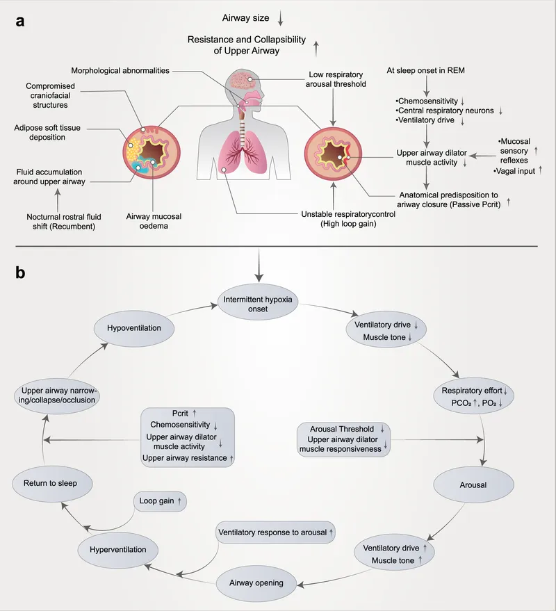 Factors and cycle of obstructive sleep apnea