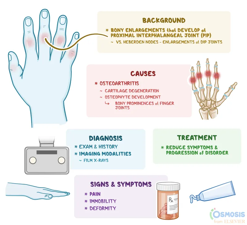 Osteoarthritis: Background, Causes, Diagnosis, Treatment