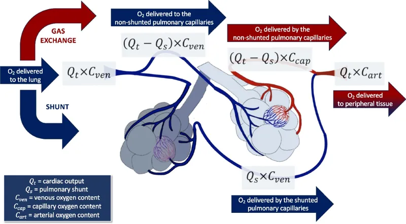 Pulmonary Shunt Equation and Oxygen Delivery