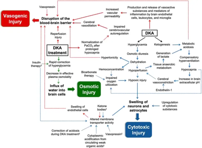 Cerebral edema pathophysiology in DKA