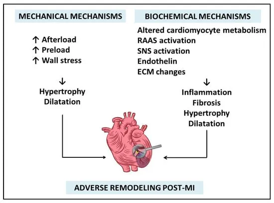 Adverse Cardiac Remodeling Post-MI: Mechanisms