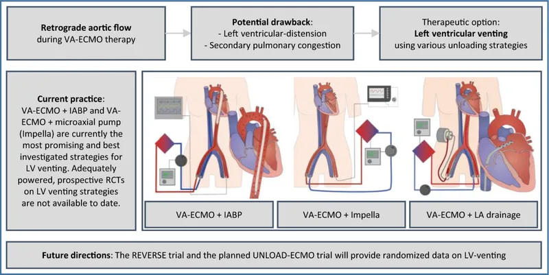 VA-ECMO with LV Venting Strategies for Cardiogenic Shock