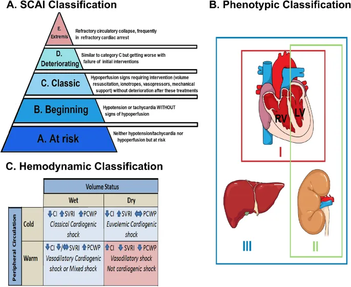 Cardiogenic Shock Classification and Hemodynamic Profile