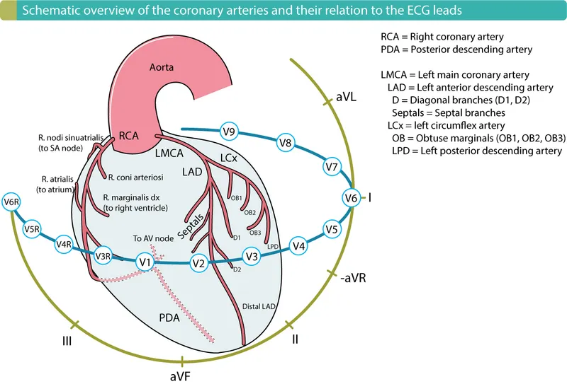 Coronary artery territories and ECG leads diagram