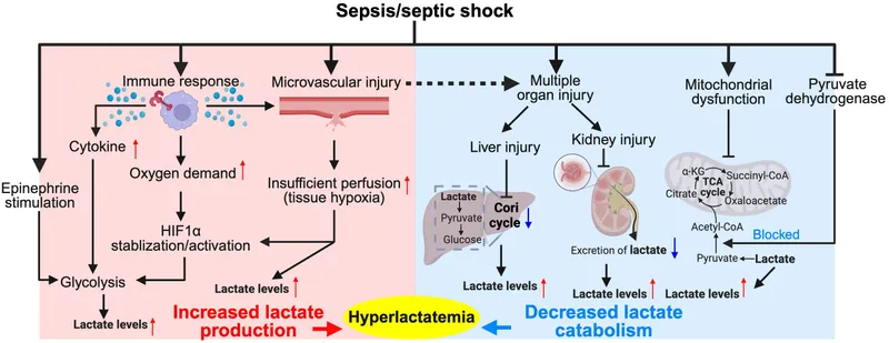 Lactate metabolism in sepsis and septic shock