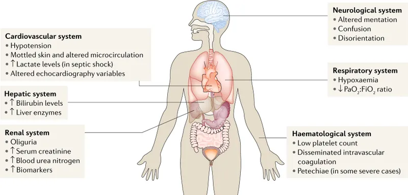 Organ dysfunction in sepsis