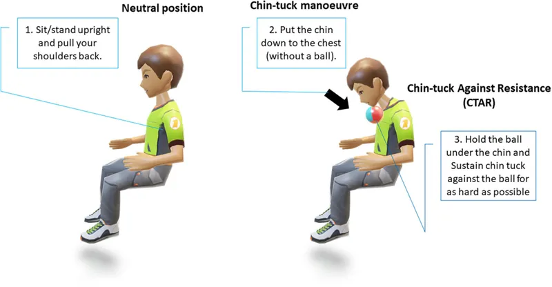Chin-tuck maneuver and chin-tuck against resistance (CTAR)