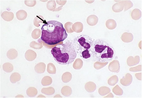 Ehrlichia morulae in a monocyte