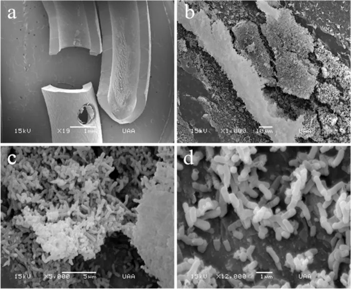 Bacterial biofilm on a catheter (SEM)