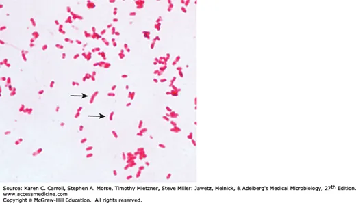 Gram stain of comma-shaped Gram-negative bacteria