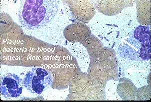 Yersinia pestis (Plague bacteria) in blood smear