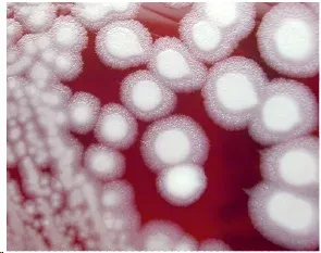 Bacillus anthracis colonies on blood agar
