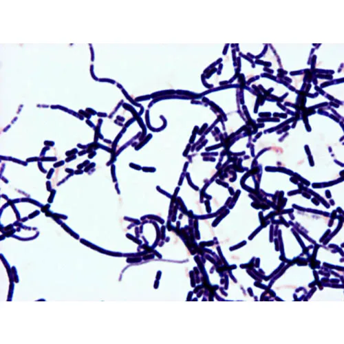 Listeria monocytogenes Gram stain microscopy