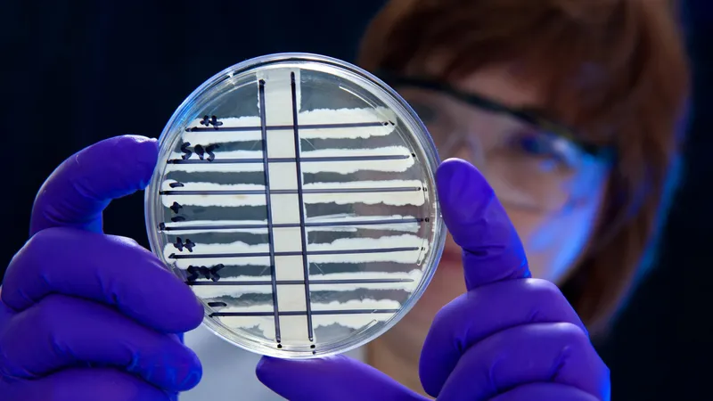Elek test plate for C. diphtheriae toxigenicity