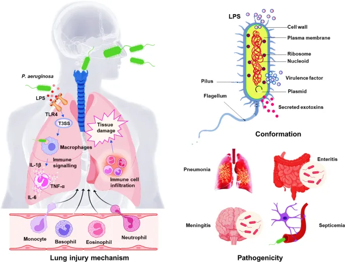 P. aeruginosa: structure, lung injury, and diseases