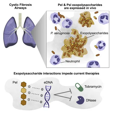 P. aeruginosa biofilm in cystic fibrosis airways
