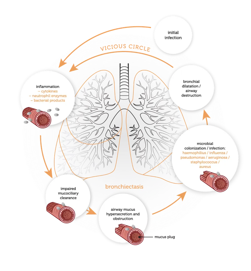 Vicious cycle of lung pathophysiology in cystic fibrosis