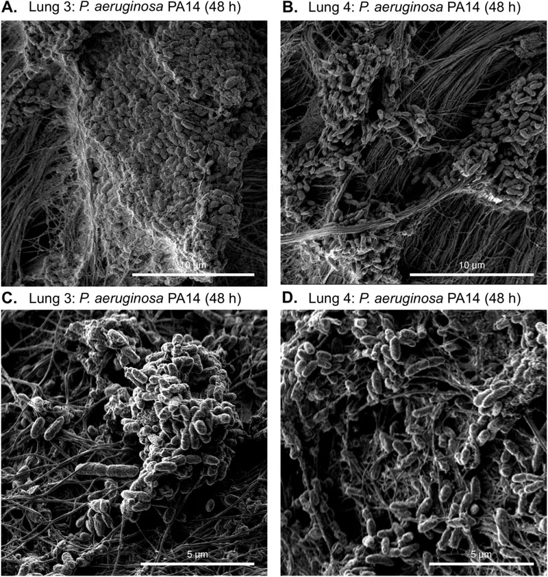 P. aeruginosa biofilm in cystic fibrosis lung tissue