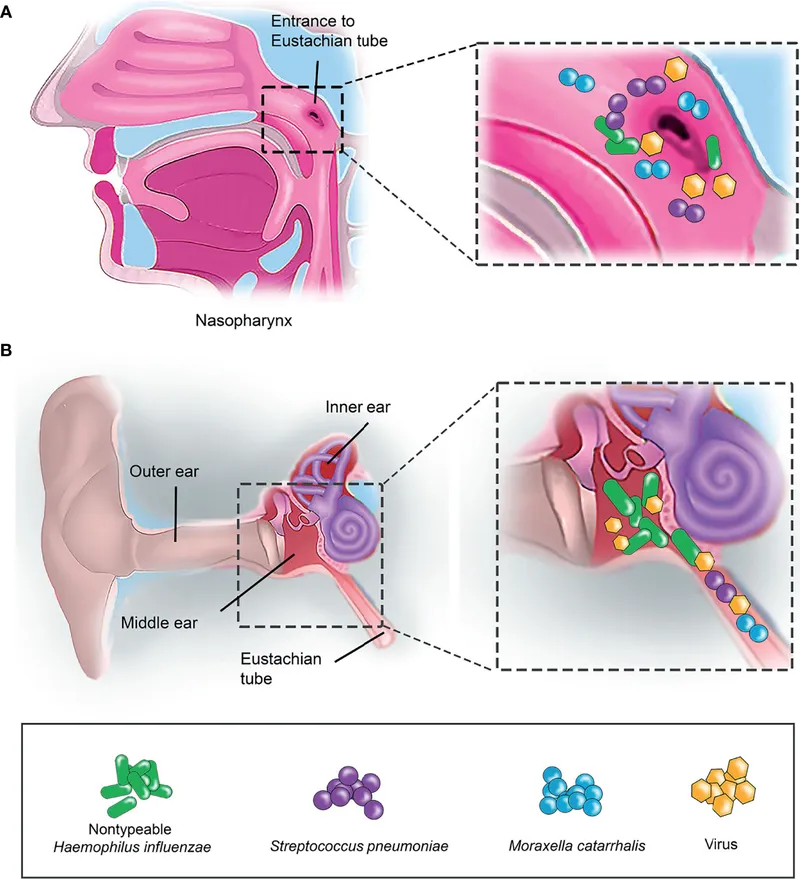 Biofilm formation in nasopharynx and middle ear