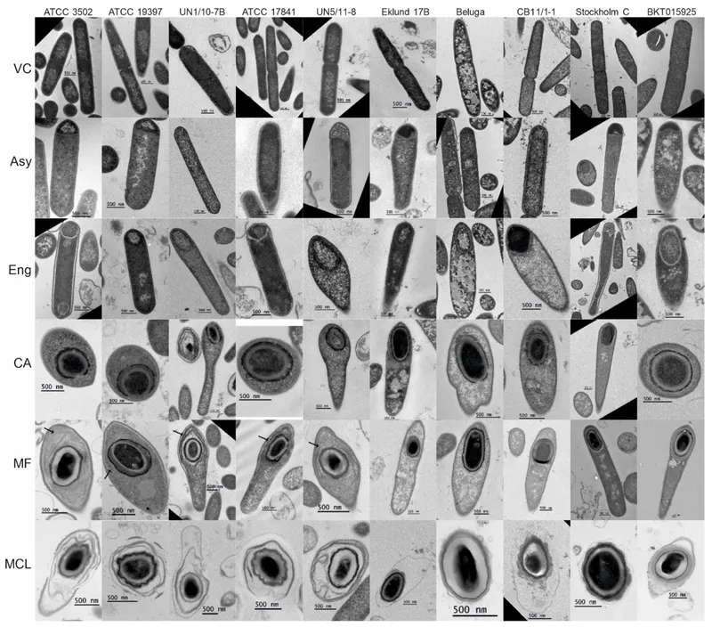 Clostridium botulinum bacteria and spores micrograph