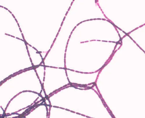 Bacillus anthracis Gram stain