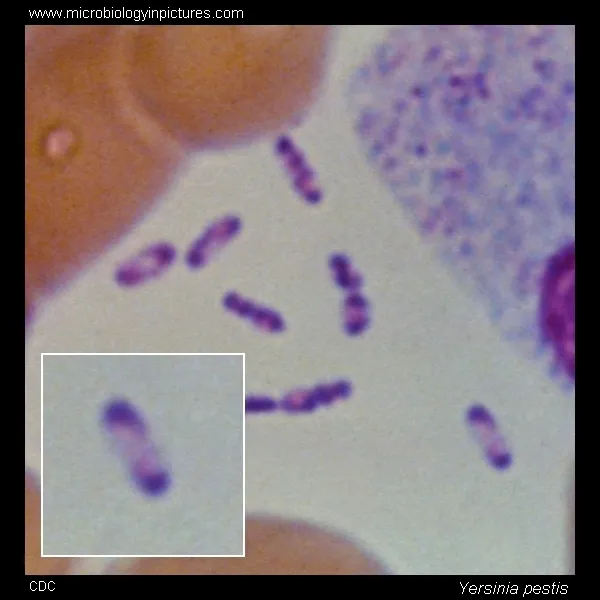 Yersinia pestis bipolar staining
