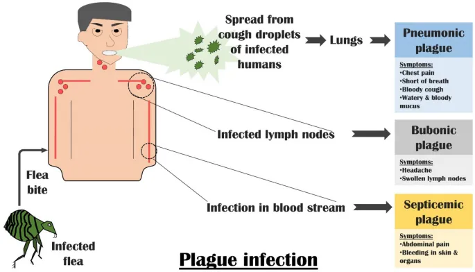 Plague infection transmission and symptoms
