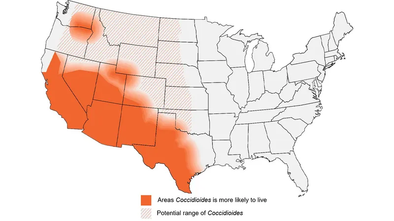 Coccidioides endemic areas in the US