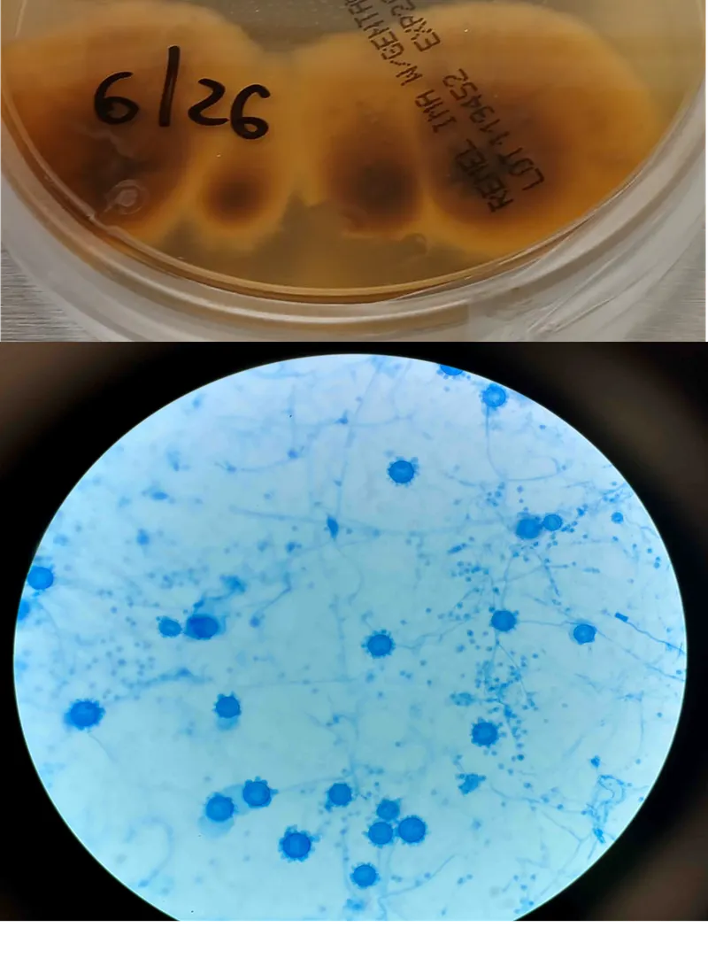 Dimorphic fungus culture: mold at 25C, yeast at 37C