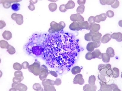 Histoplasma capsulatum yeast forms within a macrophage