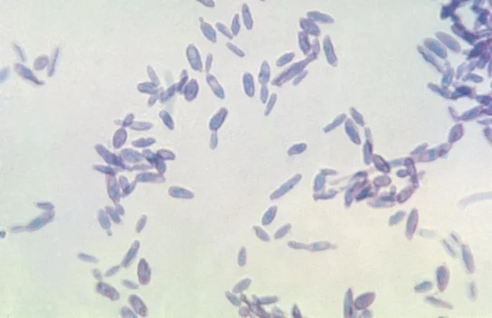 Sporothrix schenckii cigar-shaped yeast cells