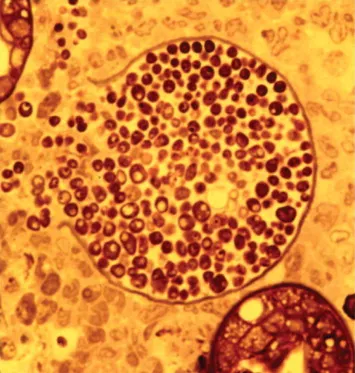 Coccidioides spherule with endospores