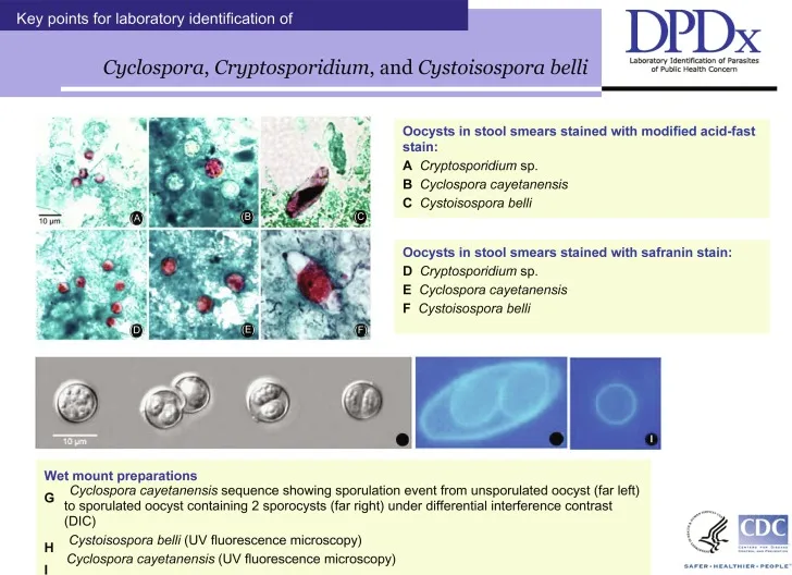 Parasitic oocysts comparison
