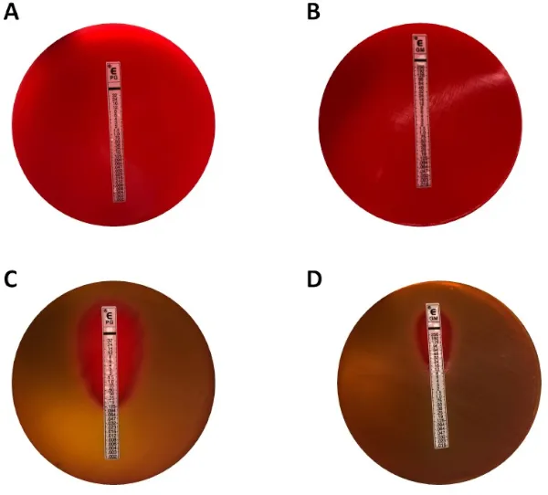E-test strips showing zones of inhibition and MIC values
