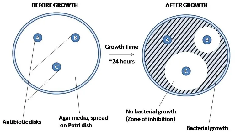 Kirby-Bauer plate with zones of inhibition