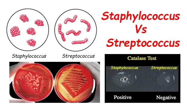 Staphylococcus vs Streptococcus: Morphology & Catalase