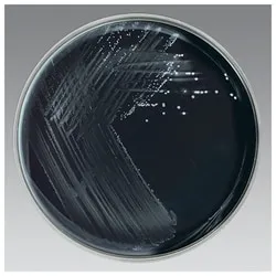 Bordetella pertussis culture on Regan-Lowe charcoal agar