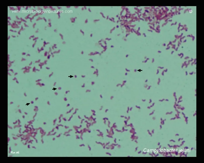 Campylobacter jejuni Gram Stain: Curved, S-shaped Rods