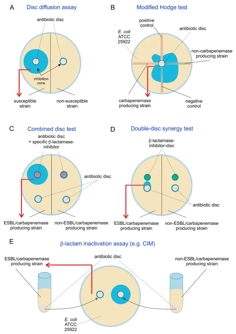 ESBL and CRE detection methods