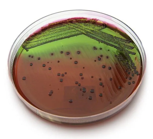 E. coli on EMB agar with metallic green sheen
