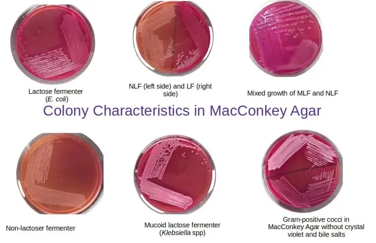 E. coli and other bacteria on MacConkey agar