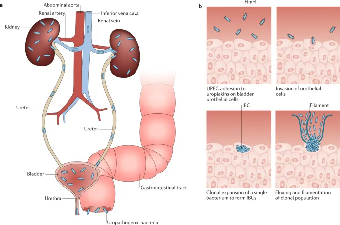 E. coli ascending urinary tract & infection mechanisms