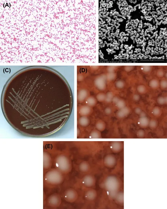 Haemophilus influenzae: Gram stain, SEM, and culture