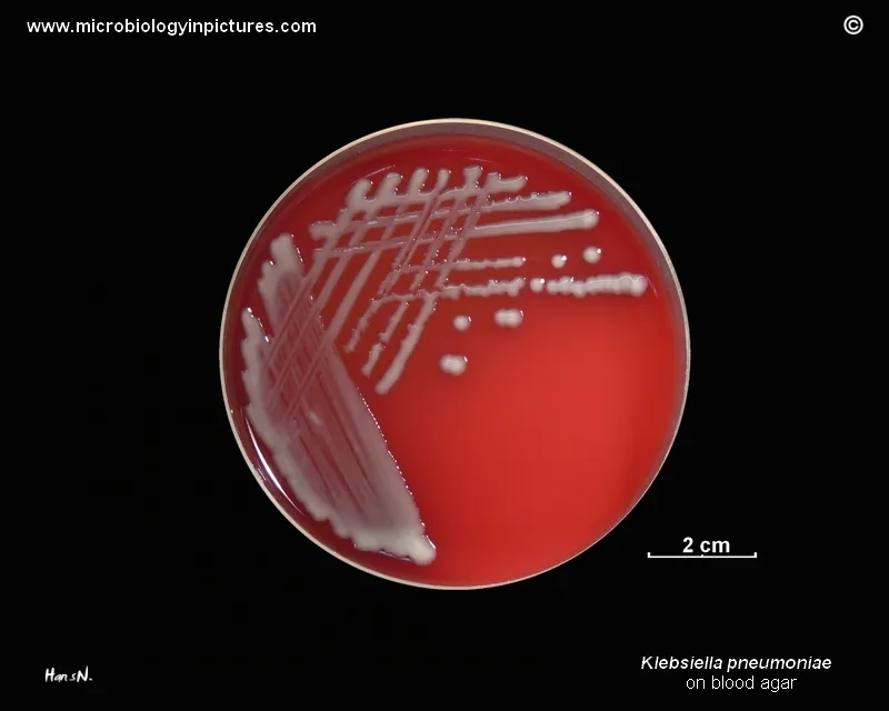 Klebsiella pneumoniae mucoid colonies on blood agar