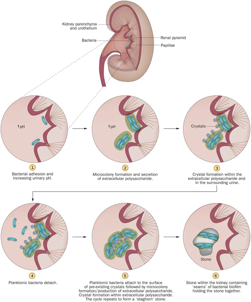 Staghorn Calculus Formation by Proteus Species
