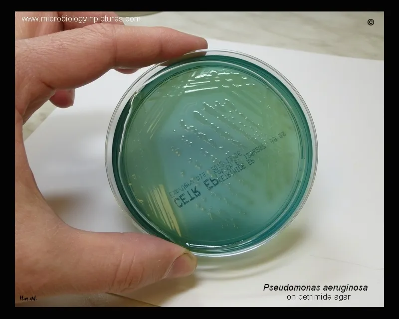 Pseudomonas aeruginosa on cetrimide agar with pyocyanin