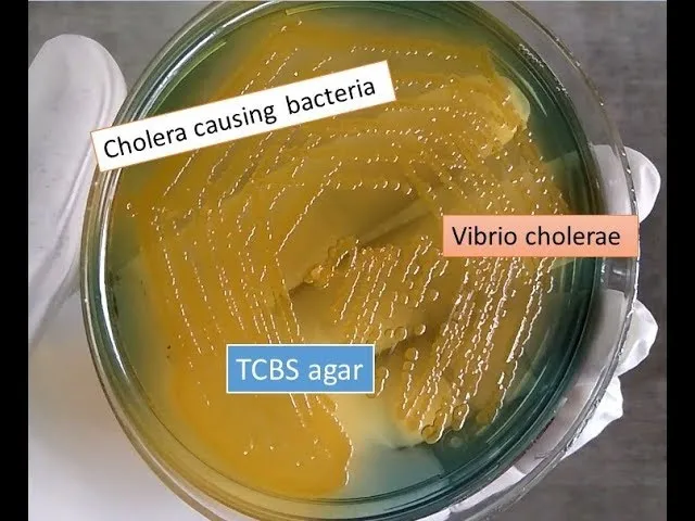 Vibrio cholerae culture on TCBS agar